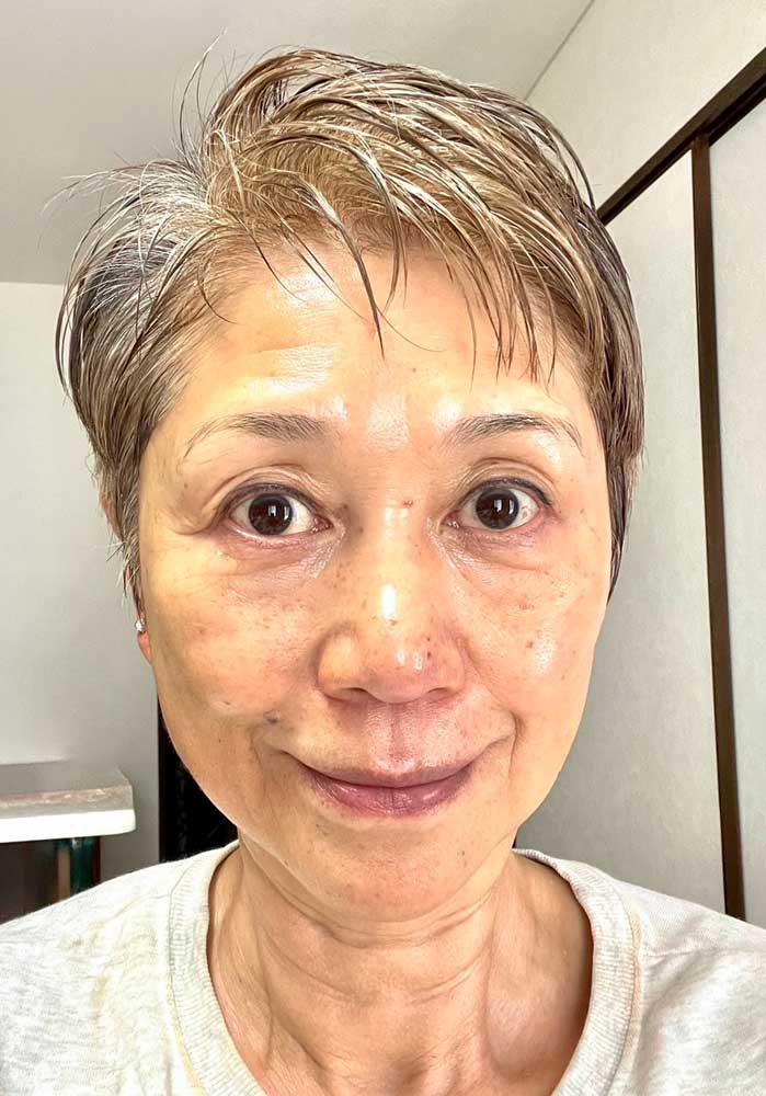 フェイスケア｜アフター