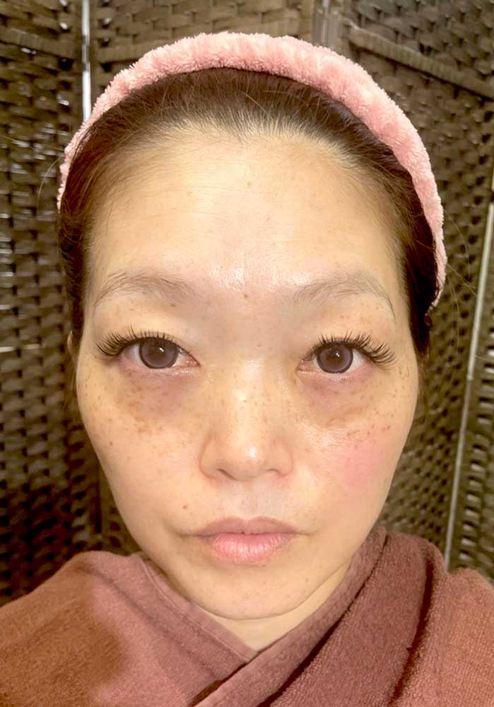 フェイスケア｜アフター