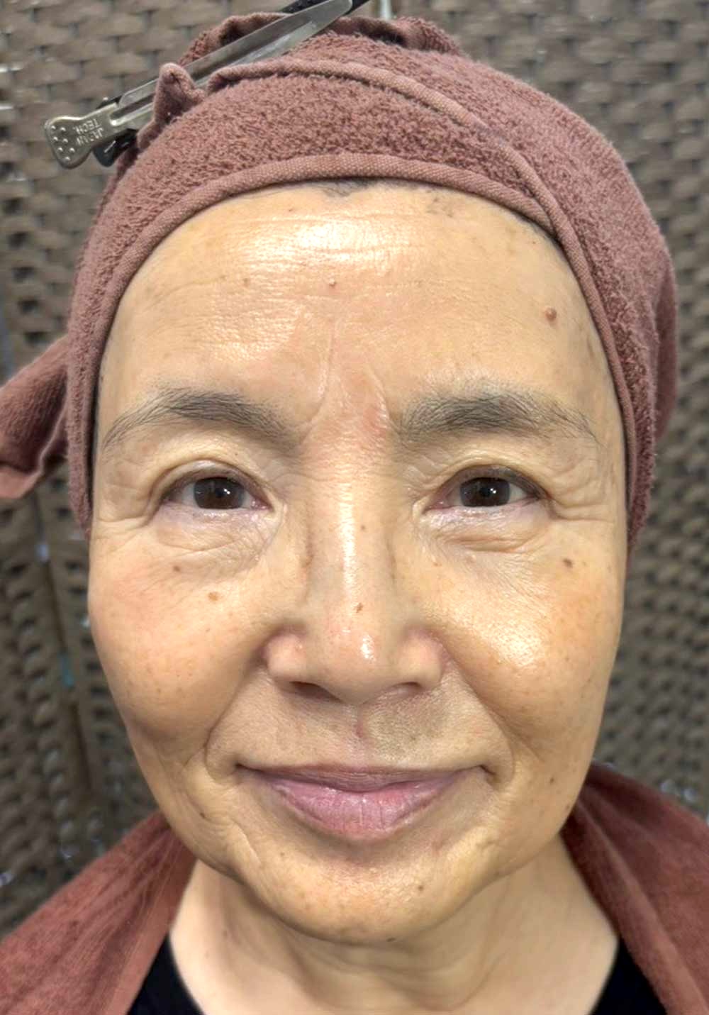 フェイスケア｜アフター