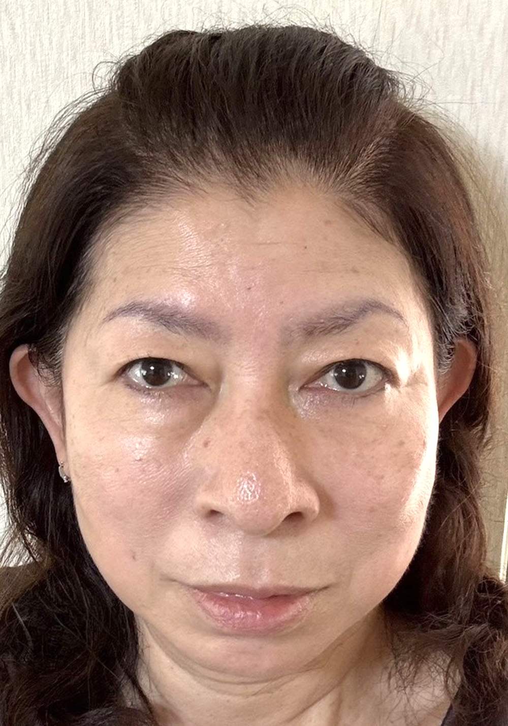 フェイスケア｜アフター