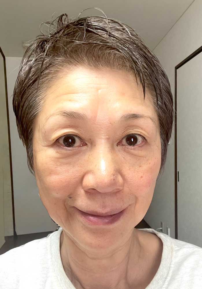 フェイスケア｜ビフォー