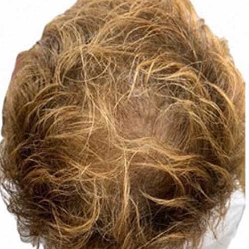 頭皮ケア｜アフター